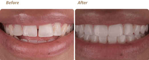 6c25a023-before-and-after-2023-01-06t115249-783_1000000000000000000028