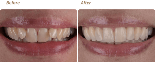 e0b17c6d-before-and-after-2023-01-06t115238-535_1000000000000000000028