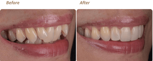 f2e4ccc0-before-and-after-2023-01-06t115311-837_1000000000000000000028